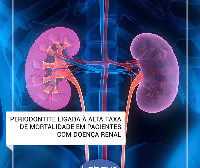 Periodontite ligada à alta taxa de mortalidade em pacientes com doença renal