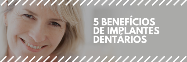 Os Benefícios dos Implantes Dentários
