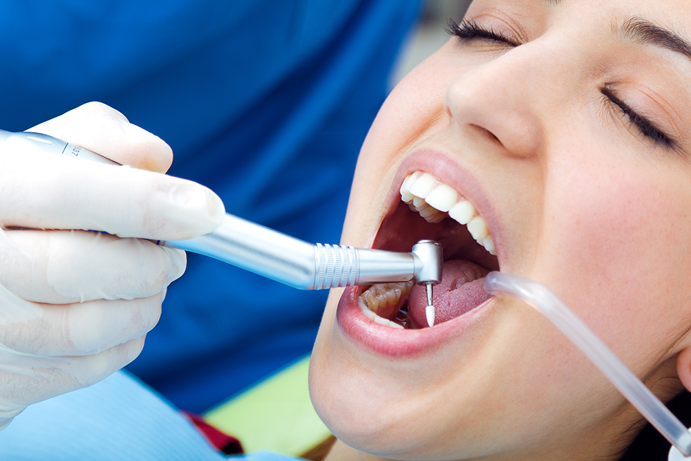 Pesquisa confirma que cárie dentária não é fator genético